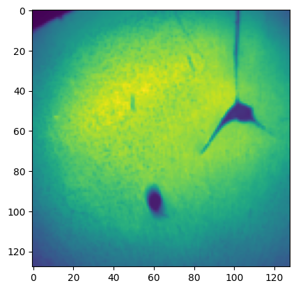 ../_images/notebooks_WSI_brain_5_2.png